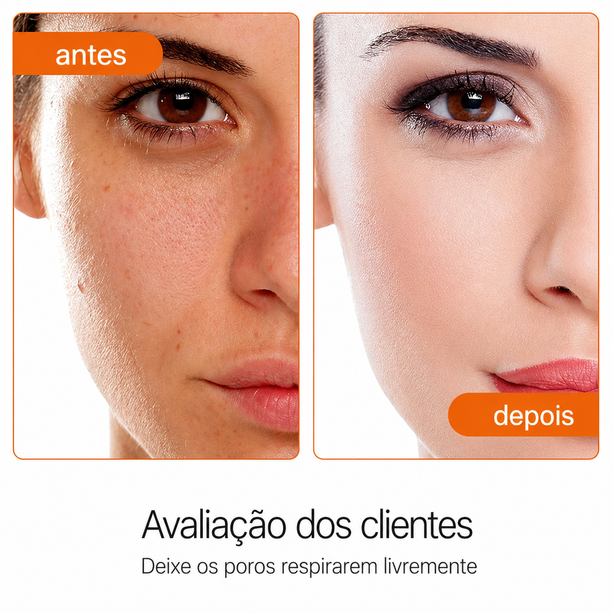 Controlador de Oleosidade JoyPretty