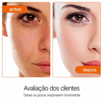 Controlador de Oleosidade JoyPretty